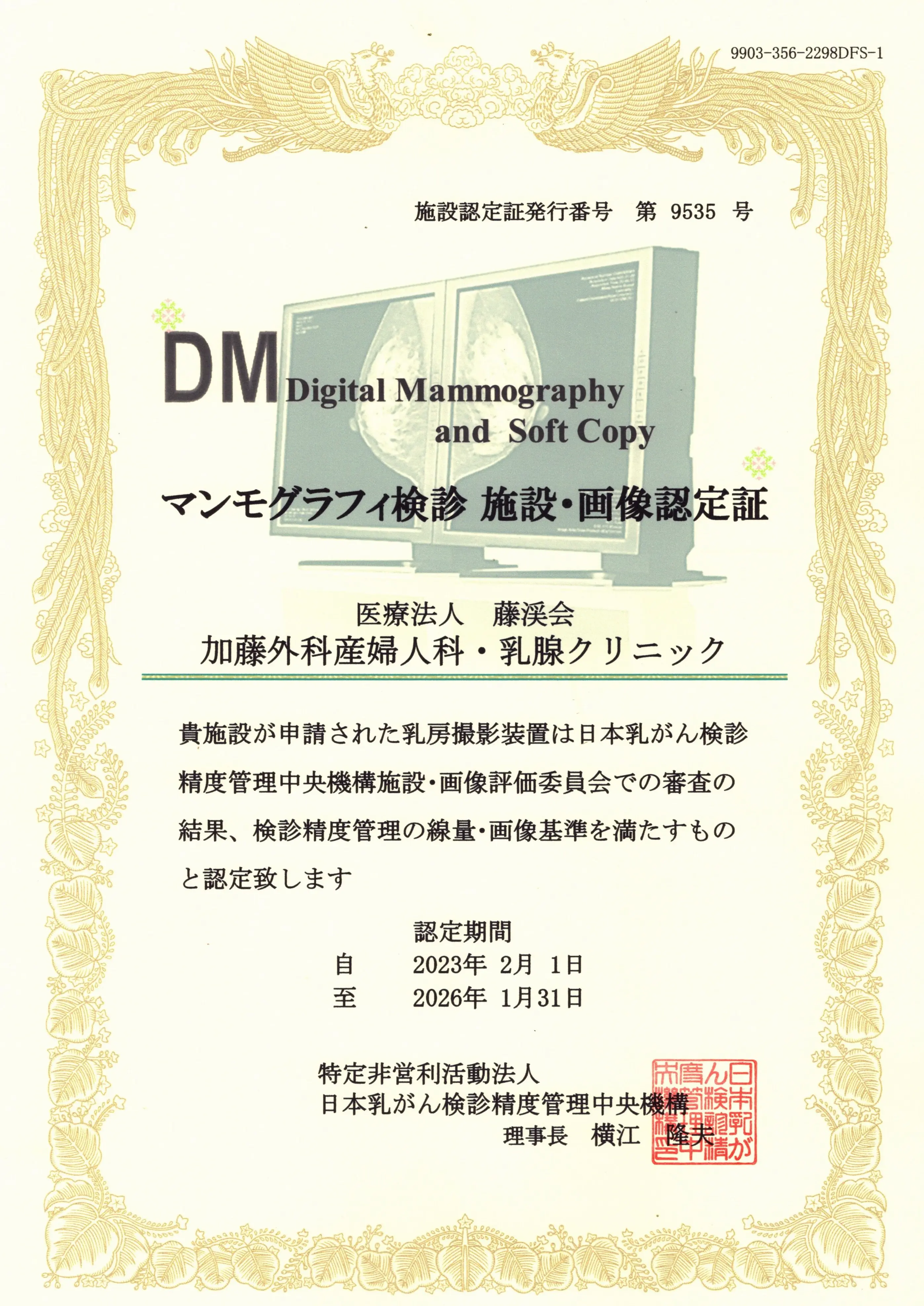 マンモグラフィ検診