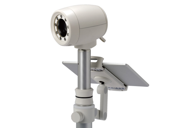 コルポスコープ検査（子宮腟部拡大鏡）